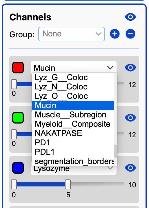 Channels_Select_Dropdown